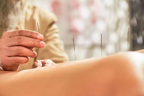 Acupunctuur | ANBO-PCOB