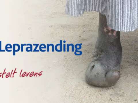 leprazending