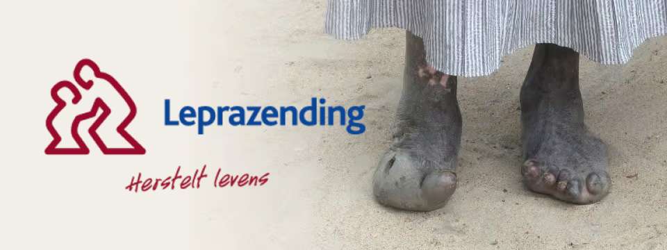 leprazending
